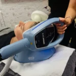 How much does Exomind Treatment cost​